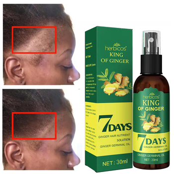 Ginger anti hair loss spray