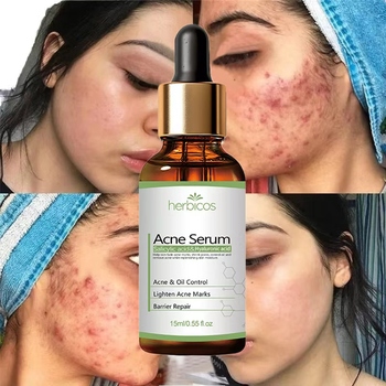 2% salicylic acid acne serum private label