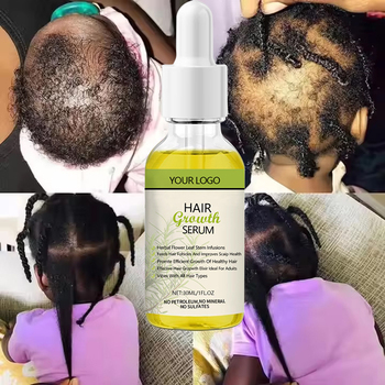 Rosemary castor hair growth oil